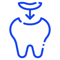 Dental Filling